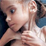 yemen_emel_aclik_hungry_humanitarian_insani